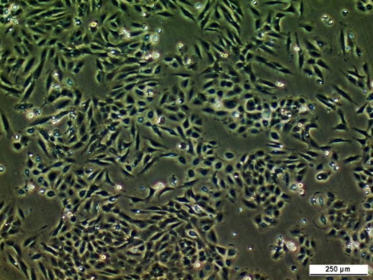 H376 Cell Line. Image courtesy of the European Collection of Authenticated Cell Cultures (ECACC), UK.