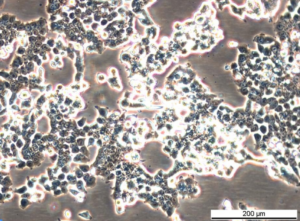 HCT 116 BRCA2 -/- [42] Cell Line. Late log phase. Image courtesy of the European Collection of Authenticated Cell Cultures (ECACC), UK.