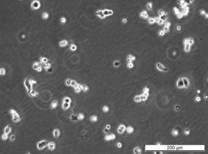 HCT 116 p300 KO [F2] Cell Line. Early log phase. Image courtesy of the European Collection of Authenticated Cell Cultures (ECACC)