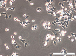 HCT 116 p300 KO [F5] Cell Line. Early log phase. Image courtesy of the European Collection of Authenticated Cell Cultures (ECACC), UK.