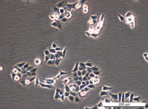 CT 116 p300 WT Cell Line. Early log phase. Image courtesy of the European Collection of Authenticated Cell Cultures (ECACC)