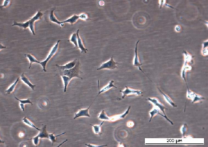 HEK293-A GFP-WIPI1 Cell Line. Early log phase. Image courtesy of the European Collection of Authenticated Cell Cultures (ECACC)