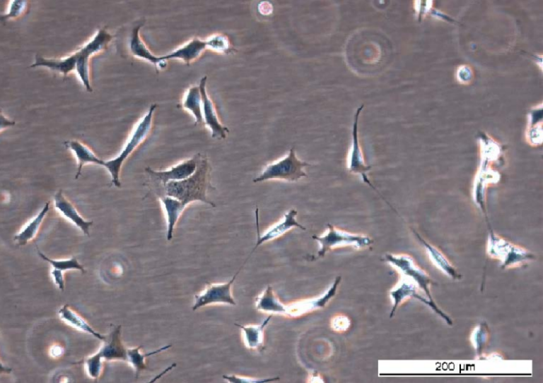 HEK293-A GFP-WIPI1 Cell Line. Early log phase. Image courtesy of the European Collection of Authenticated Cell Cultures (ECACC)