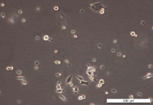 HEK293-A GFP-WIPI2 Cell Line. Early log phase. Image courtesy of the European Collection of Authenticated Cell Cultures (ECACC)