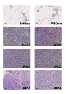 mage: Adapted from Maniati et al. 2020, Figure 1B. Tissue sections derived from normal omenta (Bl60me and FVBOme) and mouse model tumours (HGS1, HGS2, HGS3 and HGS4) stained with haematoxylin and eosin (scale bar, 100 μm).