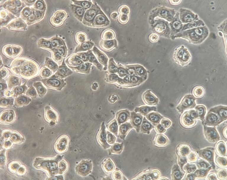 HT-29 colorectal adenocarcinoma cell line (Cat. #: 161929) shown at high magnification. Image courtesy of Memorial Sloan Kettering Cancer Center.