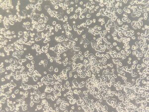 HT-29 colorectal adenocarcinoma cell line (Cat. #: 161929) shown at low magnification. Image courtesy of Memorial Sloan Kettering Cancer Center.