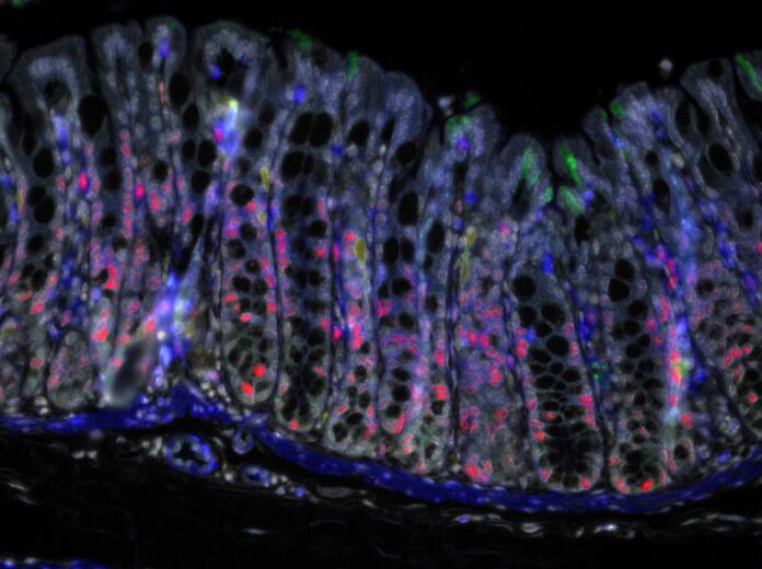 Figure 1. Human colon stained for dying cells (active caspase-3). Image by Steve Bagley (CRUK Manchester Institute) & Darren Roberts (Institute of Cancer Sciences).
