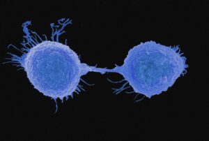 Image: Human oral squamous cell carcinoma cell line, A cell in the process of dividing. Credit: John Marshall, Tumour Biology Lab & EM Unit.