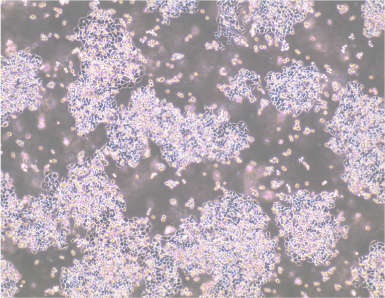 light microscope image of MB49 in culture
