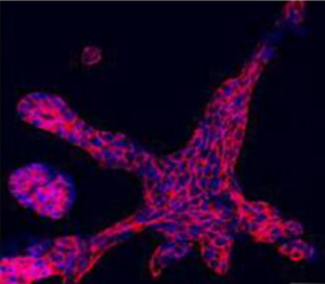 MCF10A-HER2 cells cultured in 3D formed flat projecting cells of complex masses, typical of transformed cells. Adapted from Hayat A. et al. 2023. Dis Model Mech. Feb 1;16(2). PMID: 36661191.