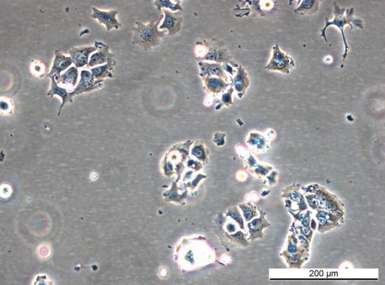MCF7 164R-7 Cell Line. Early log phase. Image courtesy of the European Collection of Authenticated Cell Cultures (ECACC)