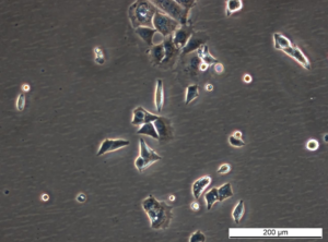 MCF7 182R-1 Cell Line. Early log phase. Image courtesy of the European Collection of Authenticated Cell Cultures (ECACC), UK.
