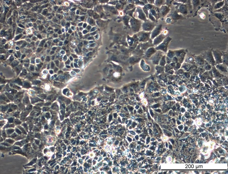 MCF7 182R-1 Cell Line. Late log phase. Image courtesy of the European Collection of Authenticated Cell Cultures (ECACC), UK.