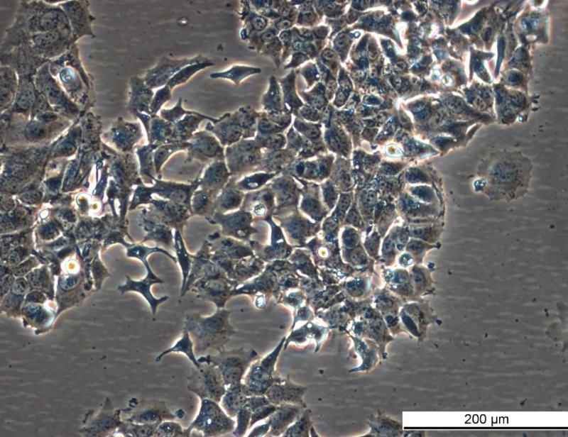 MCF7 182R-1 Cell Line. Mid log phase. Image courtesy of the European Collection of Authenticated Cell Cultures (ECACC), UK.