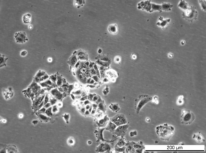 MCF7 182R-7 Cell Line. Early log phase. Image courtesy of the European Collection of Authenticated Cell Cultures (ECACC)