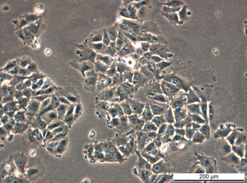 MCF7 182R-7 Cell Line. Mid log phase. Image courtesy of the European Collection of Authenticated Cell Cultures (ECACC), UK.