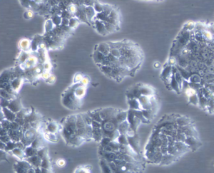 MCF7 182R-6 Cell Line. Mid log phase. Image courtesy of the European Collection of Authenticated Cell Cultures (ECACC)