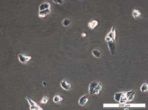 MCF7 AnaR-1 Cell Line. Early log phase. Image courtesy of the European Collection of Authenticated Cell Cultures (ECACC), UK.