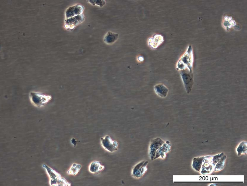 MCF7 AnaR-1 Cell Line. Early log phase. Image courtesy of the European Collection of Authenticated Cell Cultures (ECACC), UK.