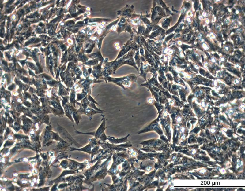 MCF7 AnaR-1 Cell Line. Late log phase. Image courtesy of the European Collection of Authenticated Cell Cultures (ECACC), UK.