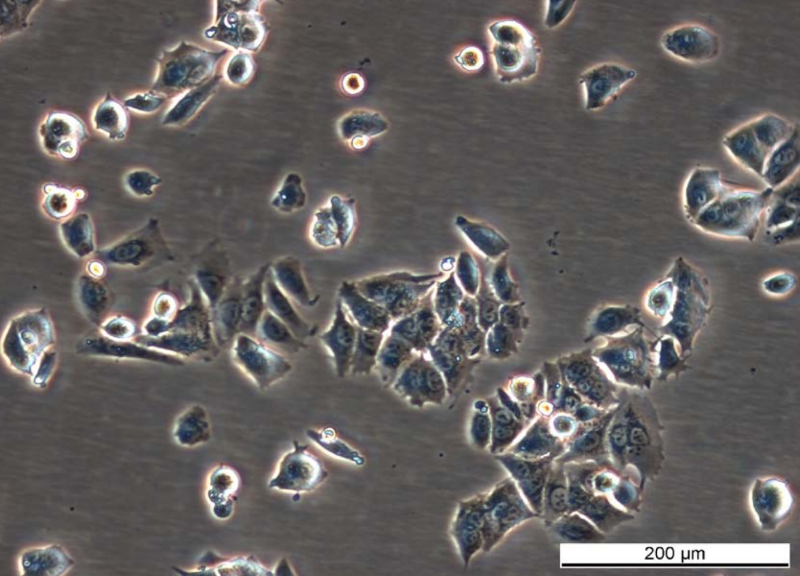 MCF7 AnaR-1 Cell Line. Mid log phase. Image courtesy of the European Collection of Authenticated Cell Cultures (ECACC), UK.