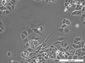 MCF7 AnaR-2 Cell Line. Early log phase. Image courtesy of the European Collection of Authenticated Cell Cultures (ECACC), UK.
