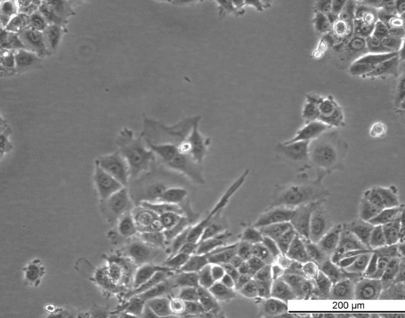 MCF7 AnaR-2 Cell Line. Early log phase. Image courtesy of the European Collection of Authenticated Cell Cultures (ECACC), UK.