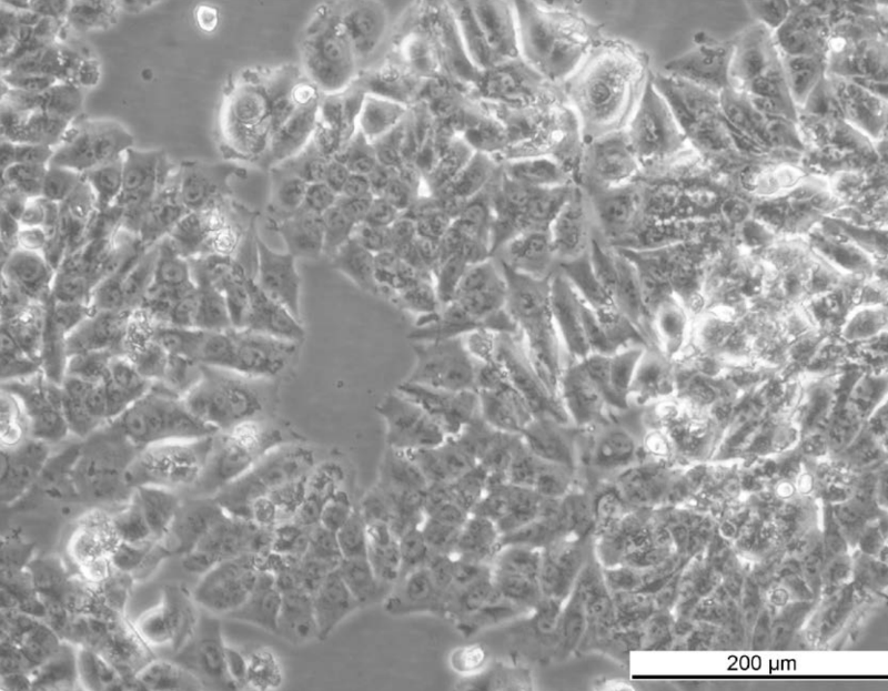 MCF7 AnaR-2 Cell Line. Late log phase. Image courtesy of the European Collection of Authenticated Cell Cultures (ECACC), UK.