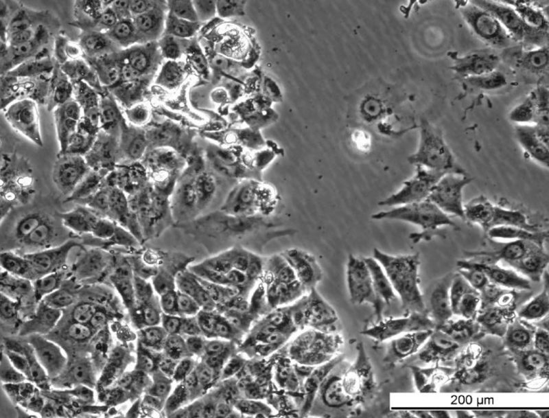 MCF7 AnaR-2 Cell Line. Mid log phase. Image courtesy of the European Collection of Authenticated Cell Cultures (ECACC), UK.