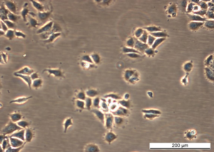 MCF7 AnaR-3 Cell Line. Early log phase. Image courtesy of the European Collection of Authenticated Cell Cultures (ECACC), UK.