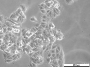 MCF7 AnaR-4 Cell Line. Mid Log phase. Image courtesy of the European Collection of Authenticated Cell Cultures (ECACC)