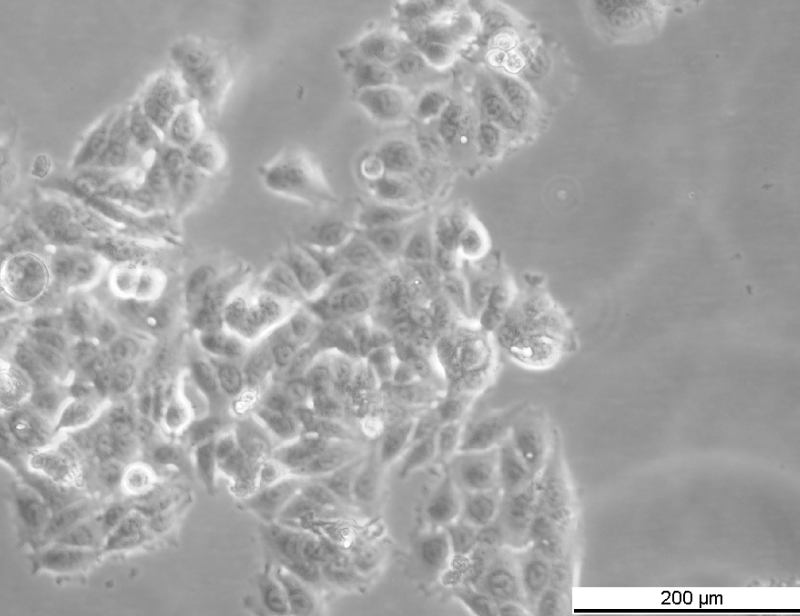 MCF7 AnaR-4 Cell Line. Mid Log phase. Image courtesy of the European Collection of Authenticated Cell Cultures (ECACC)