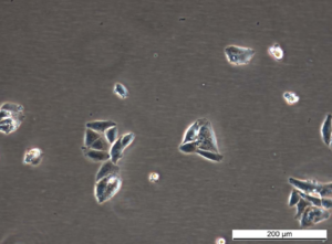 MCF7 ExeR-1 Cell Line. Early log phase. Image courtesy of the European Collection of Authenticated Cell Cultures (ECACC), UK.