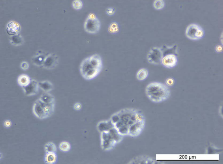 MCF7 ExeR-3 Cell Line. Early log phase. Image courtesy of the European Collection of Authenticated Cell Cultures (ECACC)