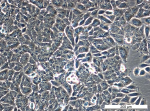 MCF7 ExeR-3 Cell Line. Late log phase. Image courtesy of the European Collection of Authenticated Cell Cultures (ECACC), UK.