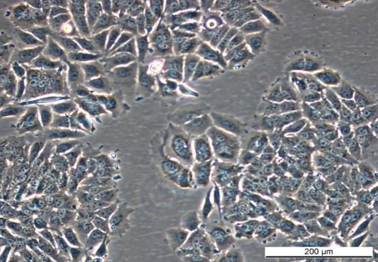 MCF7 ExeR-3 Cell Line. Mid log phase. Image courtesy of the European Collection of Authenticated Cell Cultures (ECACC), UK.
