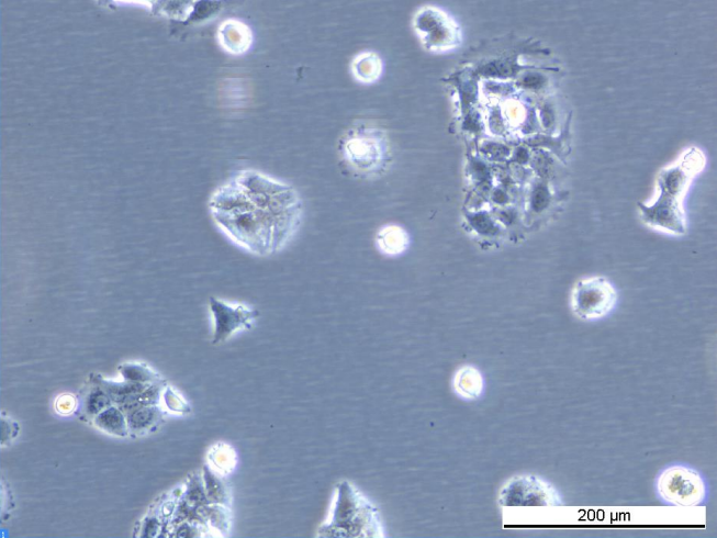 MCF7 ExeR-4 Cell Line. Early log phase. Image courtesy of the European Collection of Authenticated Cell Cultures (ECACC), UK.