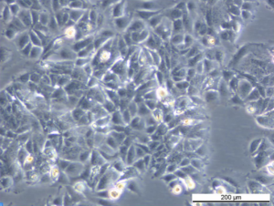 MCF7/LetR-1 Cell Line. Late log phase. Image courtesy of the European Collection of Authenticated Cell Cultures (ECACC)