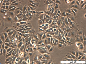 MCF7/LetR-1 Cell Line. Mid log phase. Image courtesy of the European Collection of Authenticated Cell Cultures (ECACC)