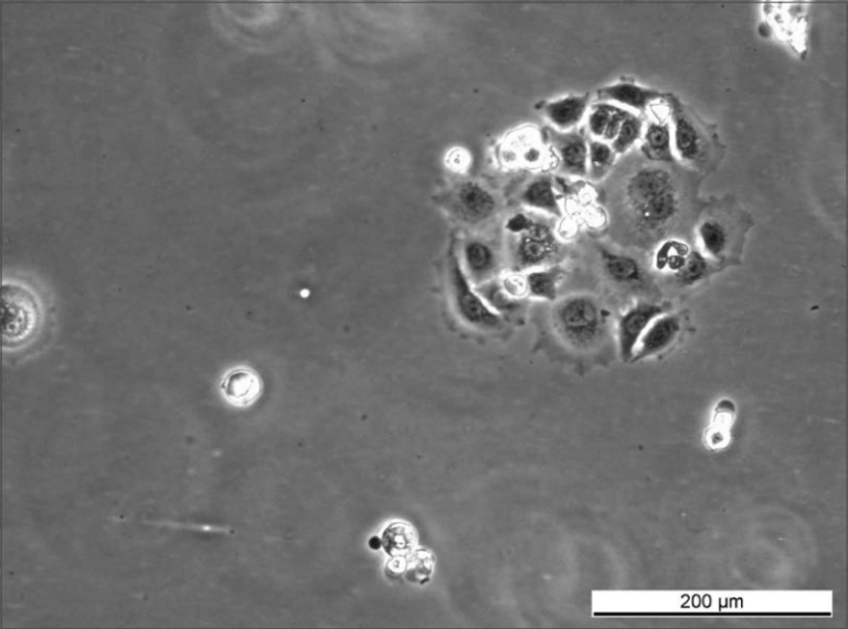MCF7 LetR-2 Cell Line. Early log phase. Image courtesy of the European Collection of Authenticated Cell Cultures (ECACC)