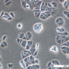 MCF7 LetR-3 Cell Line. Early log phase. Image courtesy of the European Collection of Authenticated Cell Cultures (ECACC), UK.