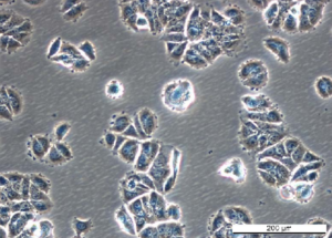 MCF7 LetR-3 Cell Line. Early log phase. Image courtesy of the European Collection of Authenticated Cell Cultures (ECACC), UK.