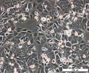 MCF7 LetR-3 Cell Line. Late log phase. Image courtesy of the European Collection of Authenticated Cell Cultures (ECACC), UK.