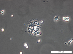 MCF7 S9 Cell Line. Early log phase. Image courtesy of the European Collection of Authenticated Cell Cultures (ECACC), UK.