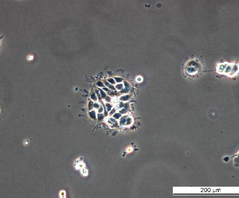 MCF7 S9 Cell Line. Early log phase. Image courtesy of the European Collection of Authenticated Cell Cultures (ECACC), UK.