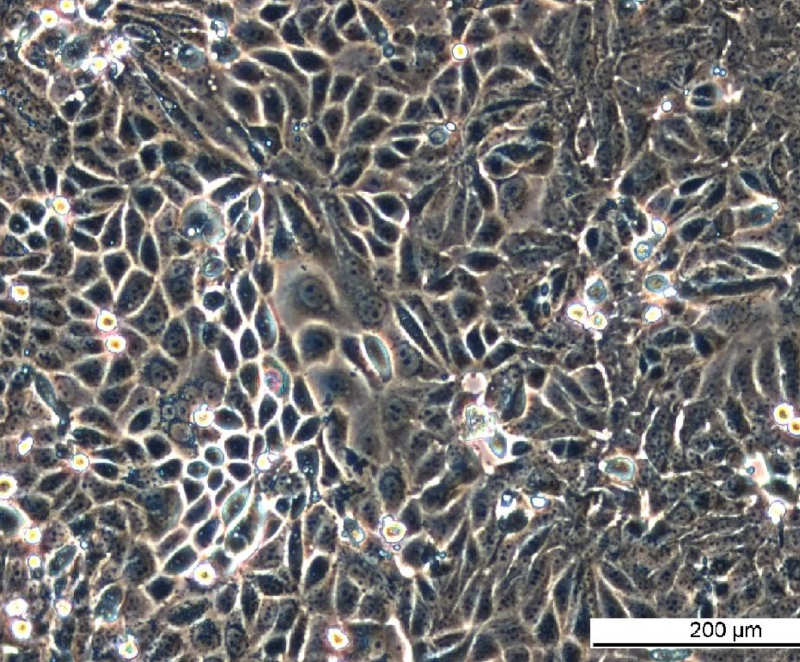 MCF7 S9 Cell Line. Late log phase. Image courtesy of the European Collection of Authenticated Cell Cultures (ECACC), UK.