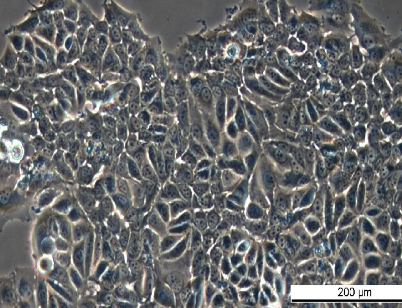 MCF7 S9 Cell Line. Mid log phase. Image courtesy of the European Collection of Authenticated Cell Cultures (ECACC), UK.