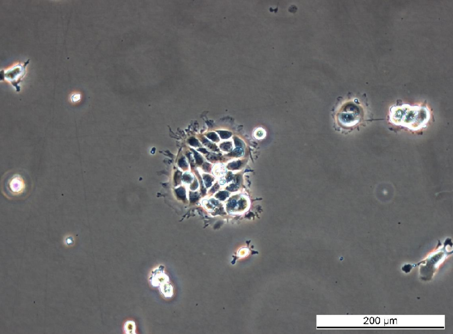 MCF7 S9 Cell Line. Early log phase. Image courtesy of the European Collection of Authenticated Cell Cultures (ECACC), UK.