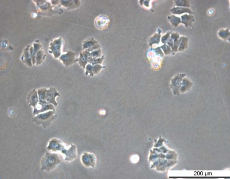 MCF7 TAMR-4 Cell Line. Early log phase. Image courtesy of the European Collection of Authenticated Cell Cultures (ECACC)